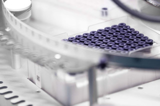Nightingale Health sample tubes on a sample rack.