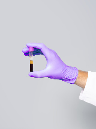 Gloved hand holding a blood sample tube for biomarker analysis, photograph.