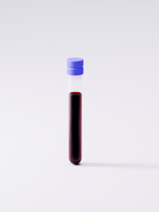 Blood sample tube on a grey background.